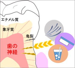 moߕq.png